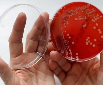 Причины гарднереллеза